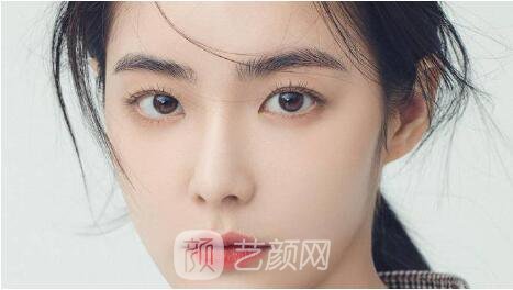 雙眼皮整形沒問題嗎？