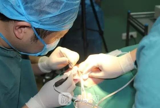 雙眼皮手術(shù)