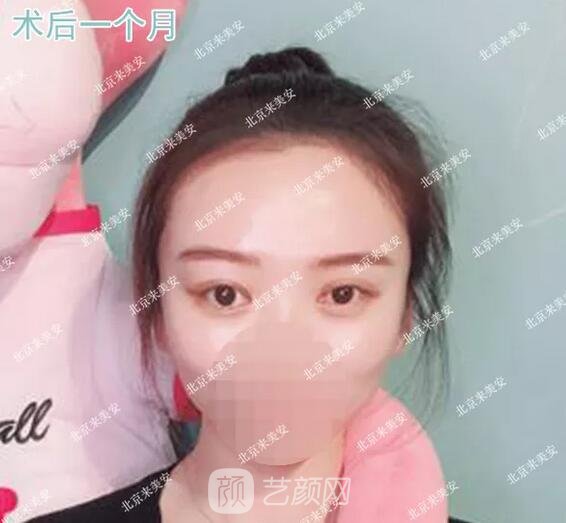 術(shù)后一個月果