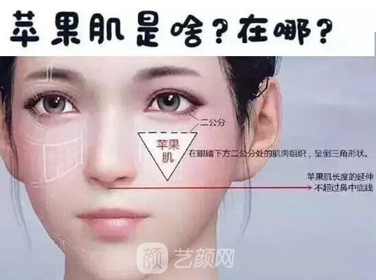 蘋果肌是什么
