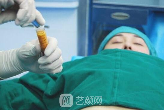 廉紅偉在水動力吸脂方面有著嫻熟的手法，他的方法對身體傷害極小