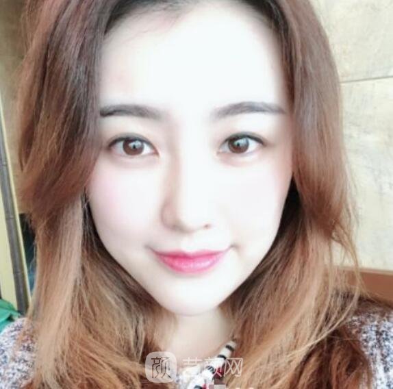 總體消化吸收的十分較為好，看上去看起來自身更年輕