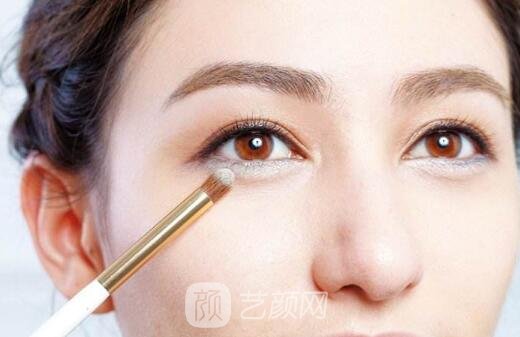 自體脂肪填充的方式也是有很多優(yōu)點(diǎn)的