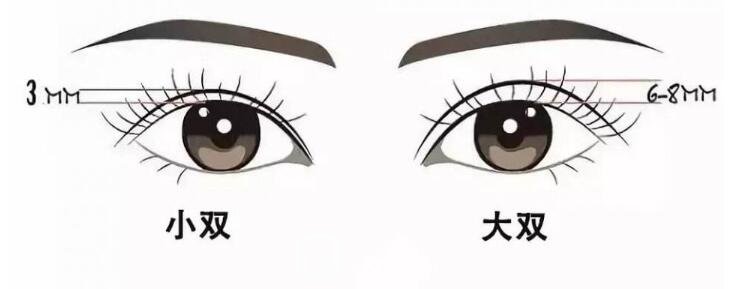 想做全切雙眼皮，寬度多少比較自然？