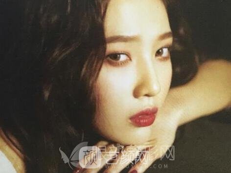 做完雙眼皮拆線之后多久才能洗臉？