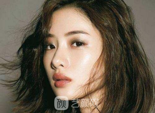 常說的微創(chuàng)雙眼皮是不是就是韓式定點雙眼皮呢？