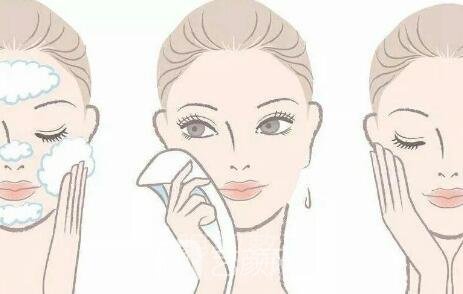 做完雙眼皮拆線之后多久才能洗臉？