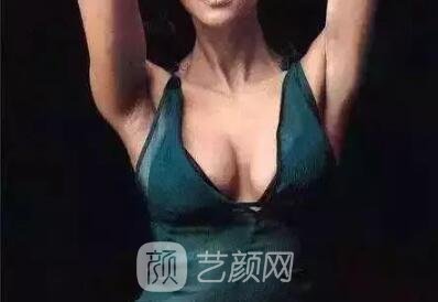 假體豐胸手術(shù)術(shù)后怎樣護理?