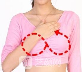 假體豐胸手術(shù)術(shù)后怎樣護理?