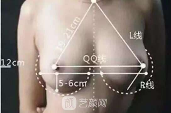 假體隆胸手感會(huì)很差嗎?