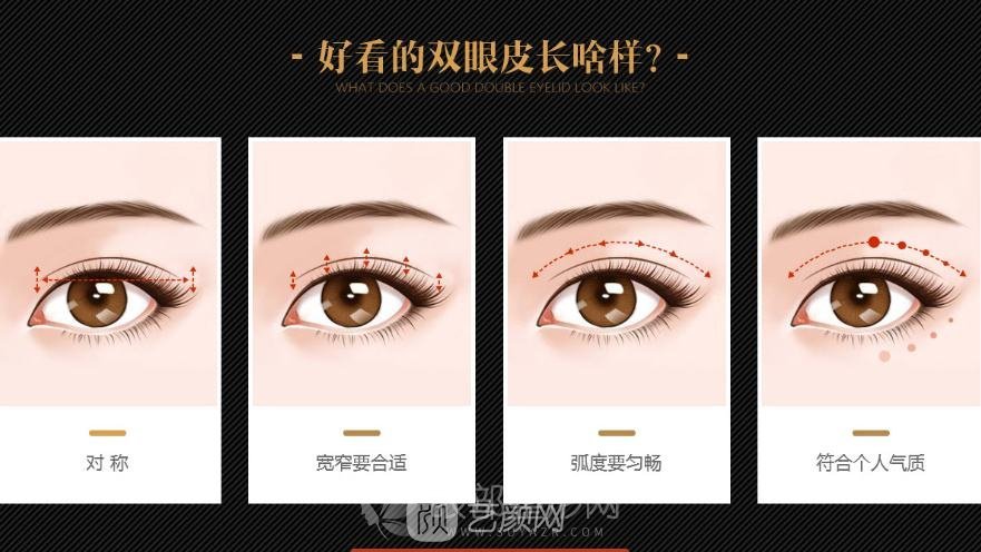 雙眼皮埋線法適合哪些人