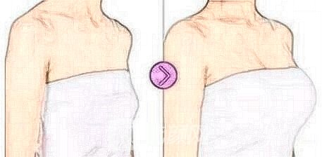 豐胸手術修復什么時候比較好?