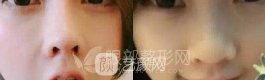 斗魚第一女主播馮提莫的進(jìn)化史：從素人到網(wǎng)紅！