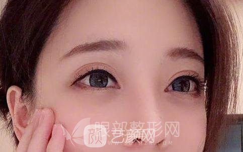 斗魚第一女主播馮提莫的進(jìn)化史：從素人到網(wǎng)紅！