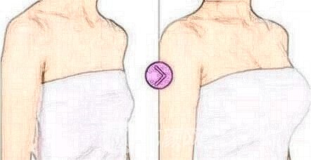 假體豐胸外觀設(shè)計和手感是否會很假?