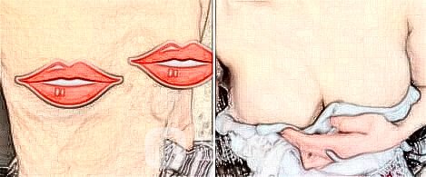 假體隆胸會痛疼嗎?造成痛疼的緣故有什么?