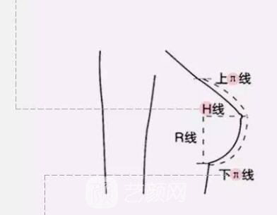 胸部下垂的解決方法?