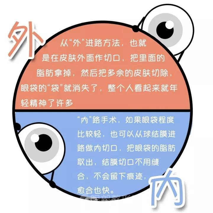 去眼袋手術(shù)哪種比較好