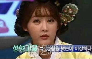 雙眼皮手術(shù)自然才好看