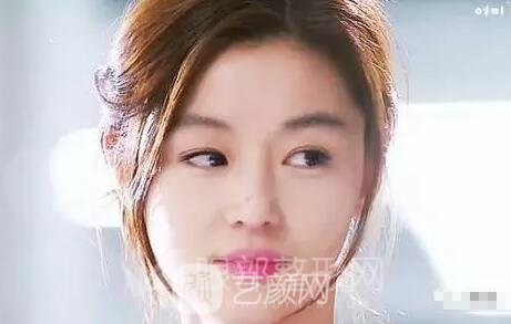 雙眼皮手術(shù)