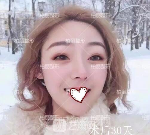 開眼角果好不好 多久恢復(fù)？