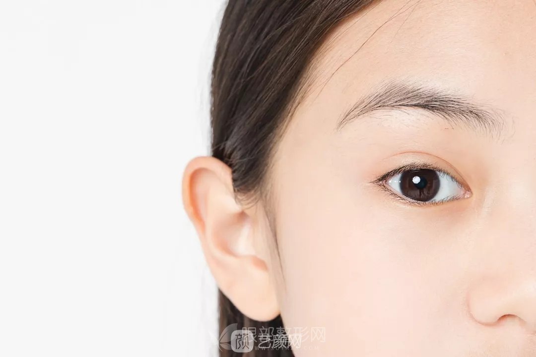 高分子雙眼皮輕松讓你變成女神，成為人群中較靚的那一個！