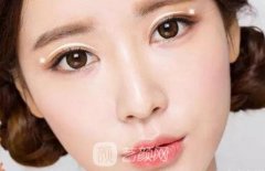 東莞第六人民醫(yī)院雙眼皮