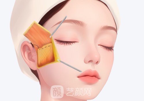 韓國(guó)美格真種植體保質(zhì)期