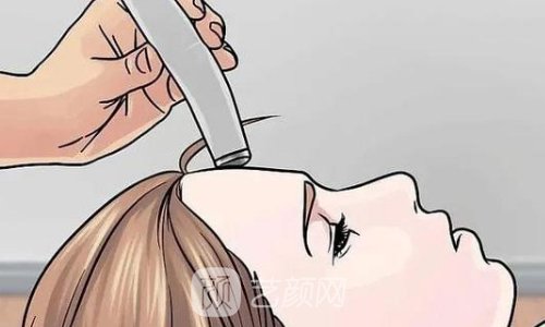 弗縵膠原蛋白的作用與功