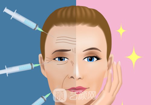 莫娜麗莎玻尿酸價格是多