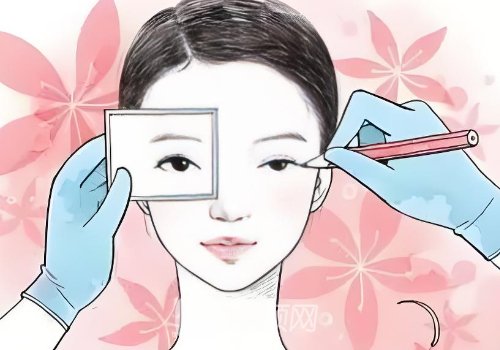 唐山做雙眼皮手術(shù)多少錢