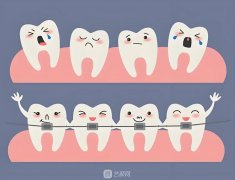 法國(guó)安卓健種植牙多少錢(qián)