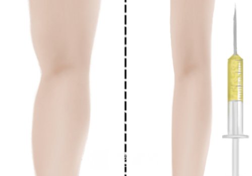 冰月嵐綠溶脂的成分有哪