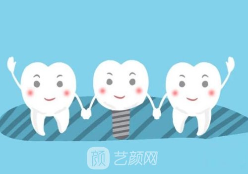 法國安卓健種植牙是什么