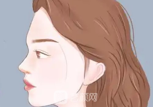 成都隆鼻修復(fù)價(jià)格公開分