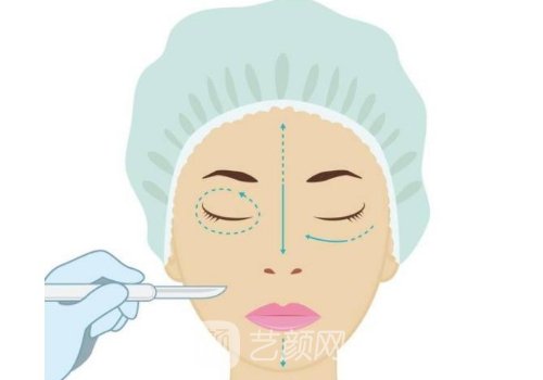 邁諾威溶脂針什么時候上