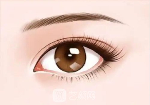 南京割雙眼皮需要多少錢